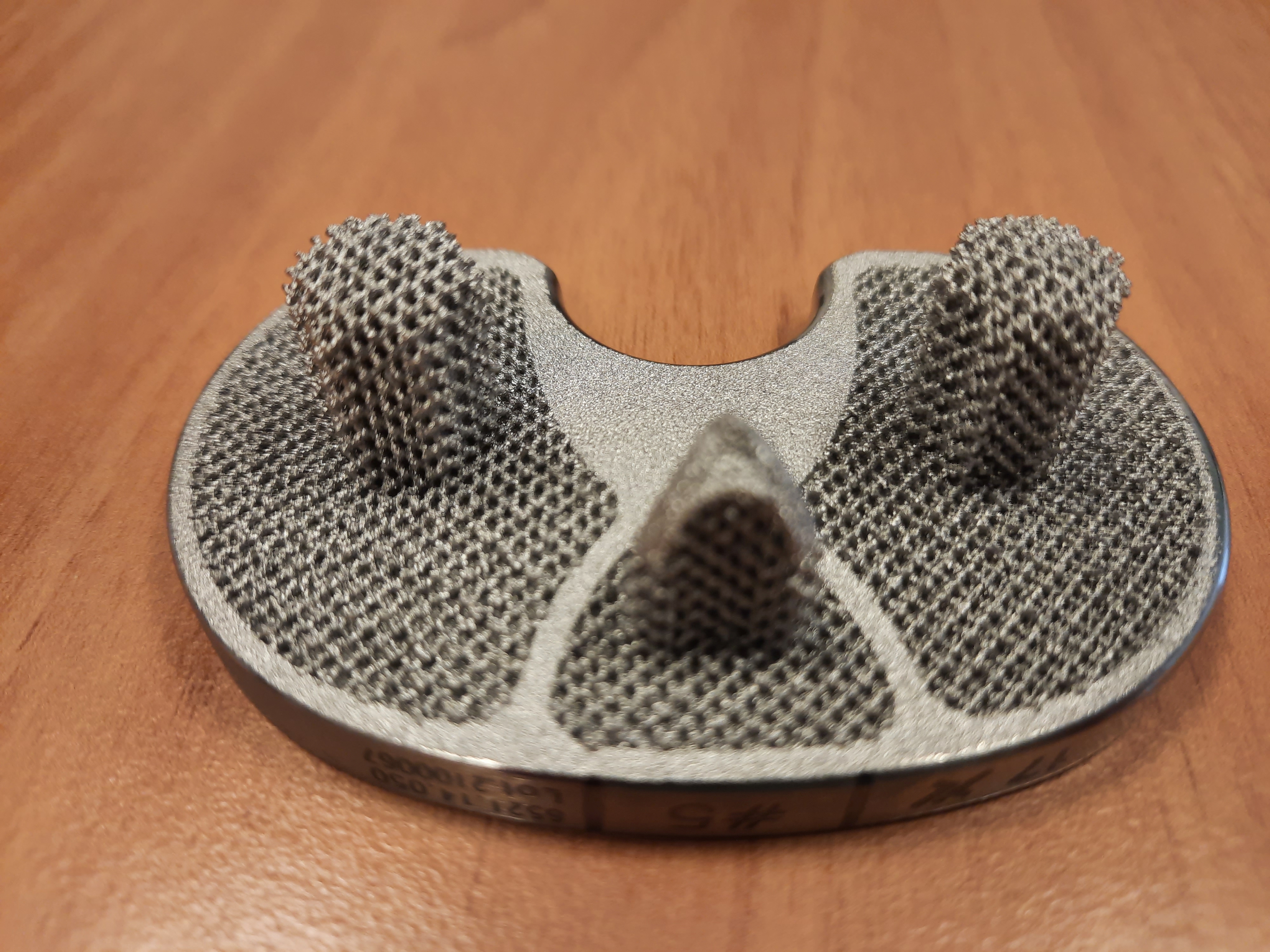 Chirurgia, al Gemelli impiantata protesi ginocchio stampata in 3D, prima mondiale