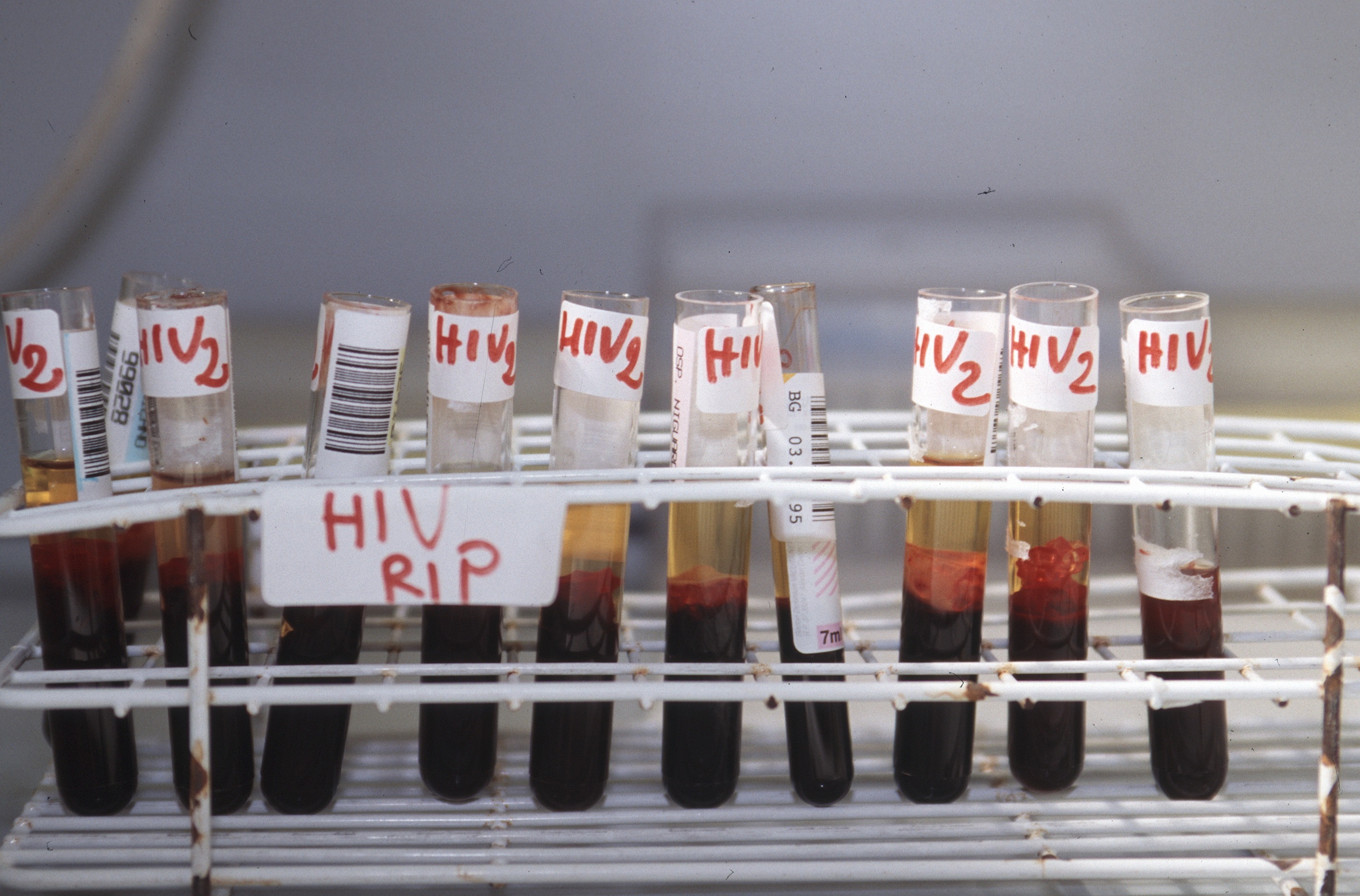 Aids, scoperto nuovo meccanismo di replicazione del virus