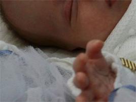 Ricerca, da Padova baby 'pancreas artificiale' per neonati