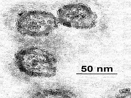 I virus giganti? Sono 'Frankenstein' di mini microbi