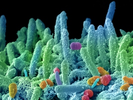 'Made in Italy' la nanotecnologia contro i super batteri