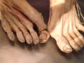 Asl romane 'visitano' cadavere mutilato mostra Real Bodies