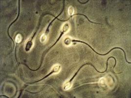 Spermatozoi dall'orecchio contro sterilit genetica maschile