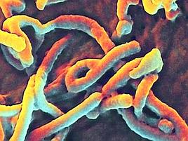 Ebola non  l'unica, epidemie in aumento nel mondo